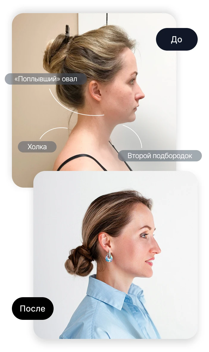 young woman beauty